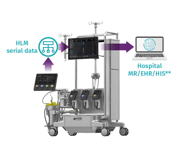 Essenz Perfusion System Access install