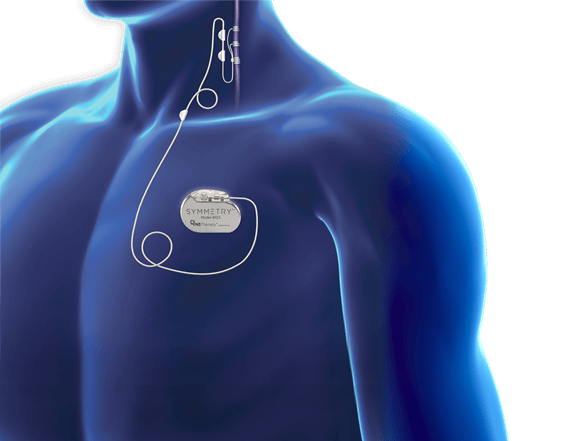 Body showing the placement of VNS Therapy device and lead