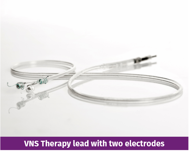 vns device lead