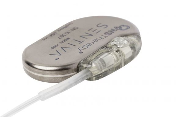 How a tiny implant can stop seizures from happening