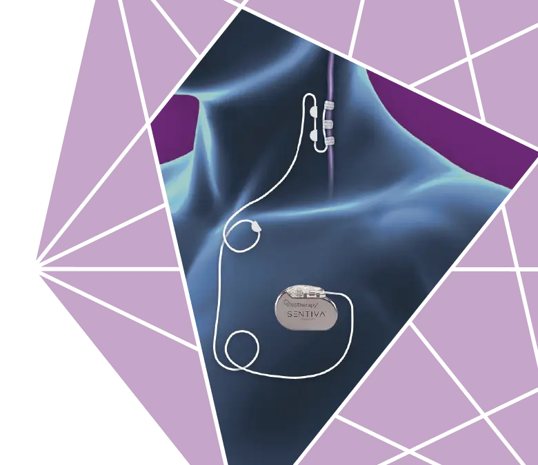 SenTiva® VNS Therapy device