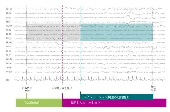 SenTiva™ detects and responds to rapid increases in heart rate that may be associated with a seizure