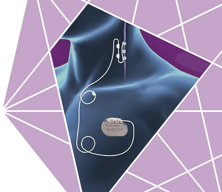 SenTiva™ VNS Therapy device