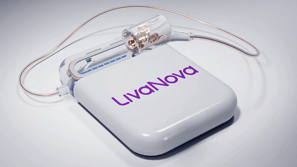Illustrative LivaNova pHGNS device for OSA